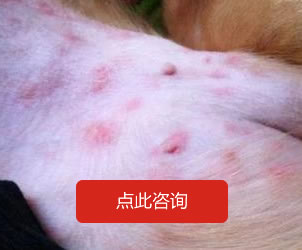 体股癣